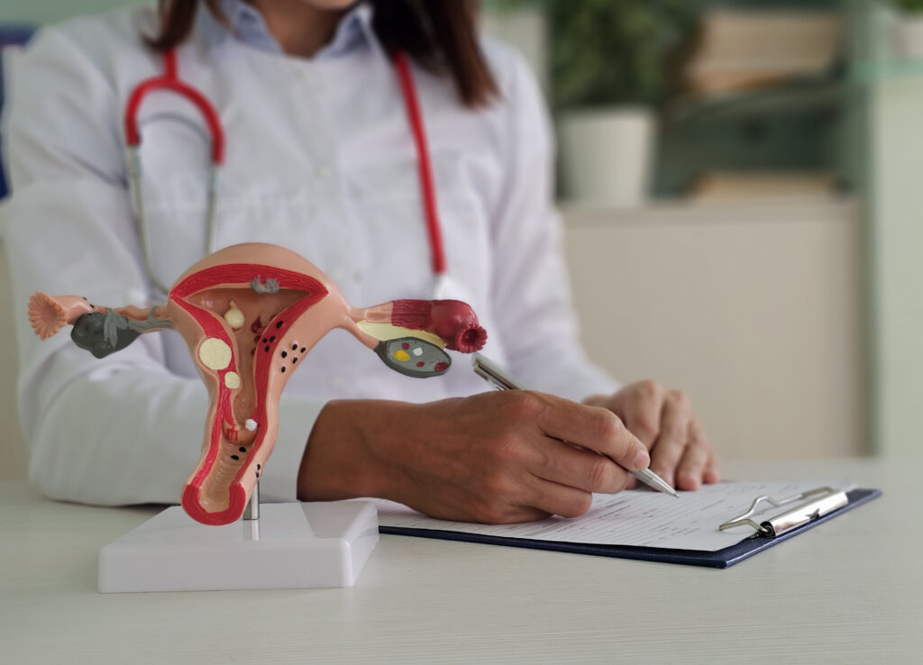 Gynecologist model of the female reproductive system. Uterus Doctor shows structure of female reproductive organs at educational seminar and ultrasound
