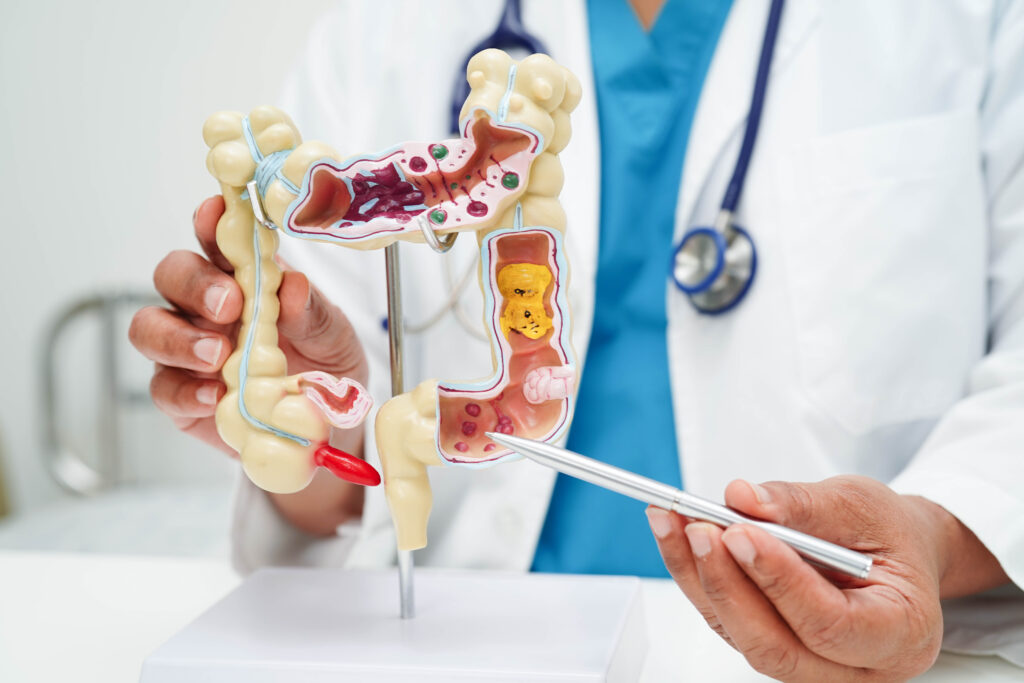 a doctor pointing to a 3D model of a colon to explain what happens during a colon cancer screening